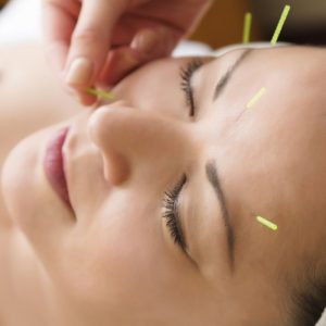 Ophthalmic Acupuncture Experience