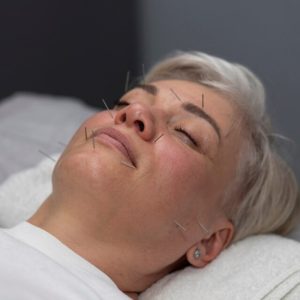 Beauty Acupuncture Experience